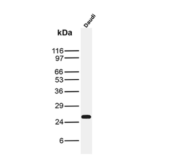 SCGB2A2 Antibody