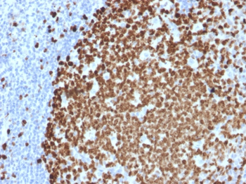 MKI67 Antibody