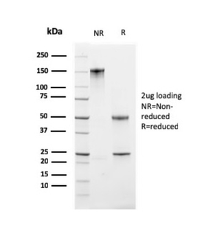 MKI67 Antibody