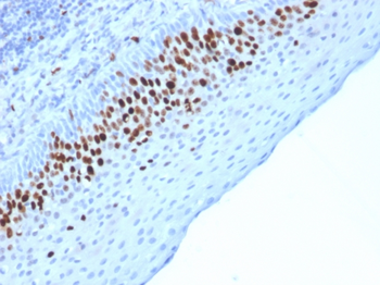 MKI67 Antibody