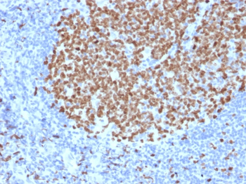 MKI67 Antibody