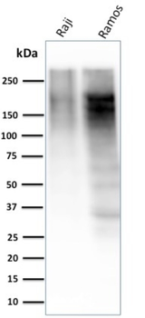 MKI67 Antibody