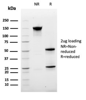 MKI67 Antibody