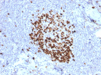 MKI67 Antibody
