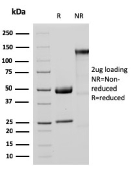 MTAP Antibody