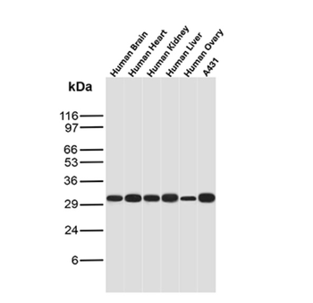MTAP Antibody