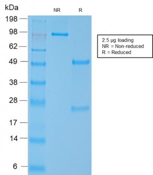 MYH11 Antibody