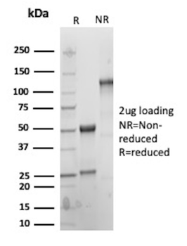 MYH11 Antibody