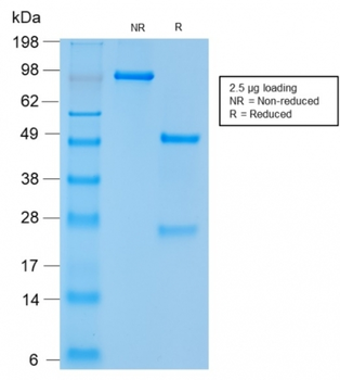 NCAM1 Antibody