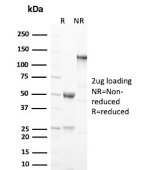 NCAM1 Antibody