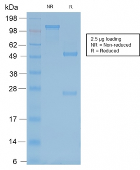 NEFH Antibody