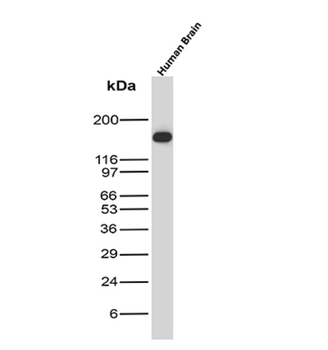NEFH Antibody