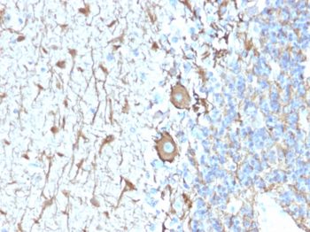 NEFH Antibody