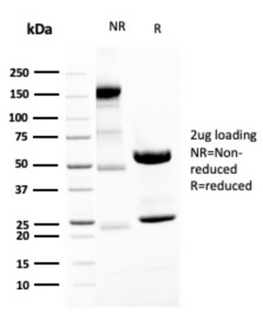 NEFH Antibody