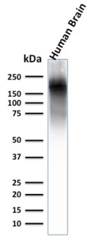 NEFH Antibody