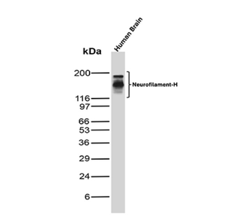 NEFH Antibody