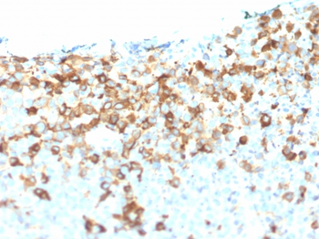 NGFR Antibody