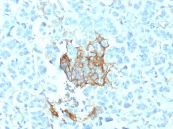 NGFR Antibody