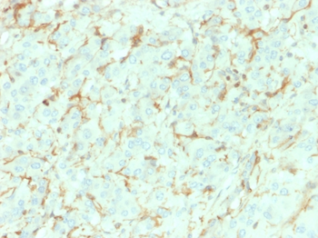 NGFR Antibody