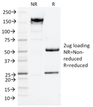 NGFR Antibody