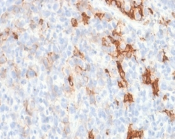 NGFR Antibody