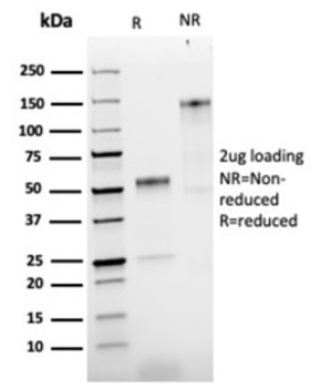 NGFR Antibody