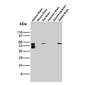 NGFR Antibody