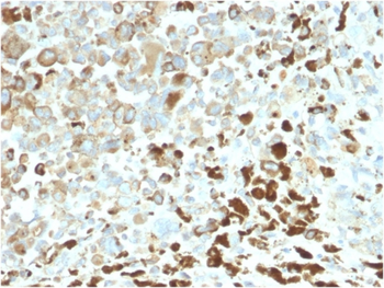 NGFR Antibody