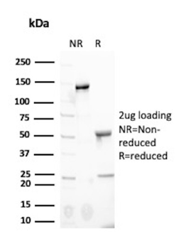 NGFR Antibody