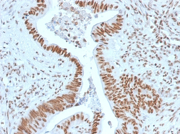 NPM1 Antibody