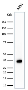 NPM1 Antibody