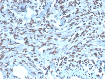 PAX2 Antibody