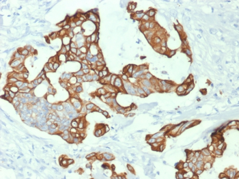 KRT20 Antibody
