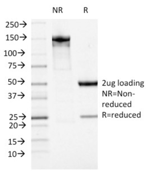ATRX Antibody