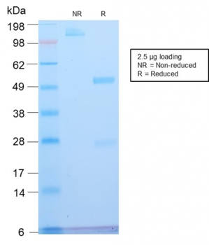 ATRX Antibody