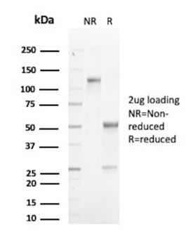 ATRX Antibody