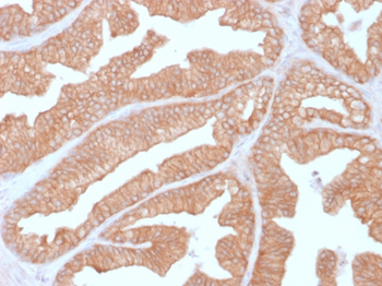 PPP3CA Antibody