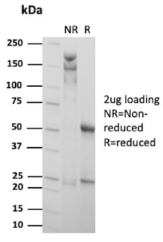 PPP3CA Antibody