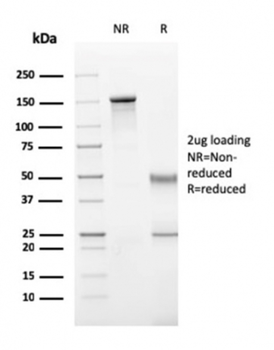 PRF1 Antibody