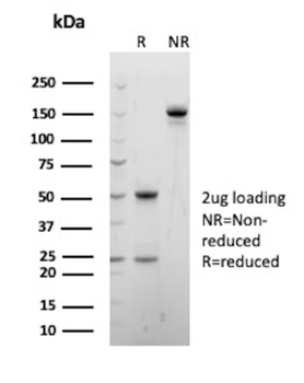PRF1 Antibody