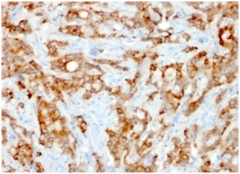B2M Antibody