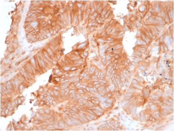 B2M Antibody