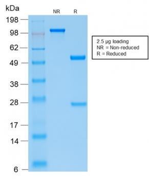 PTH Antibody