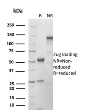 PTH Antibody