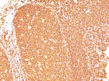 PTPRC Antibody