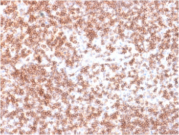 PTPRC Antibody