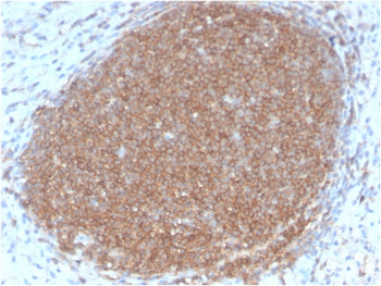 PTPRC Antibody