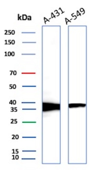 RAD51 Antibody