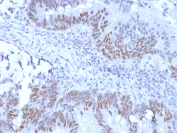 RB1 Antibody