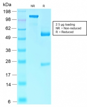 RB1 Antibody